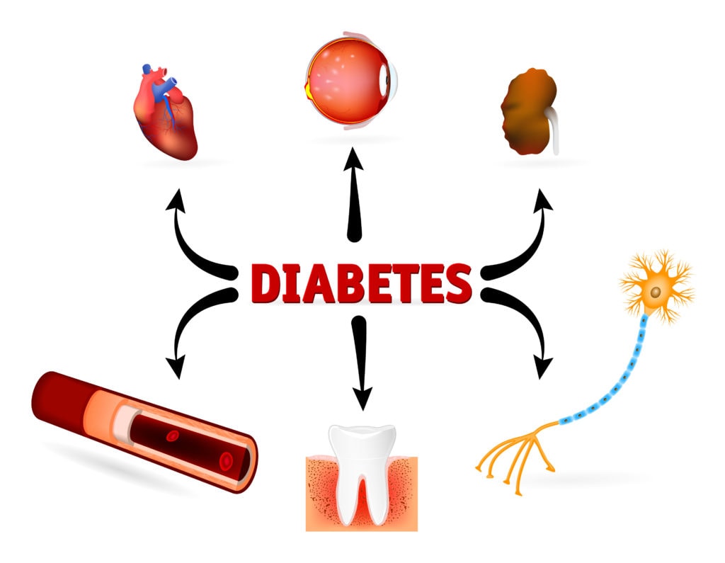 diabetes-complicaties-voorkomen-of-omkeren-thenewfood