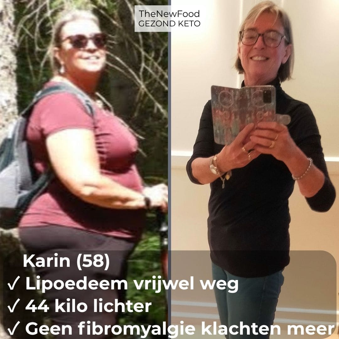 44 KILO KWIJT,  FIBROMYALGIE OVER EN LIPOEDEEM VRIJWEL WEG