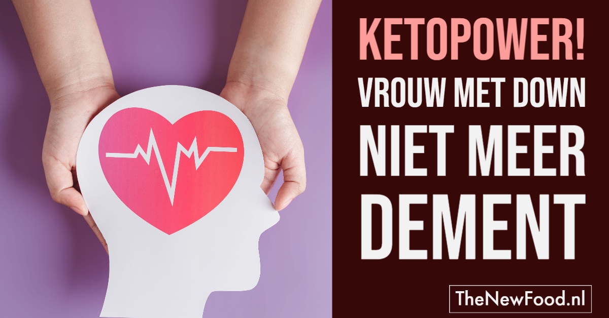 Alzheimer bij vrouw met Down verdwenen