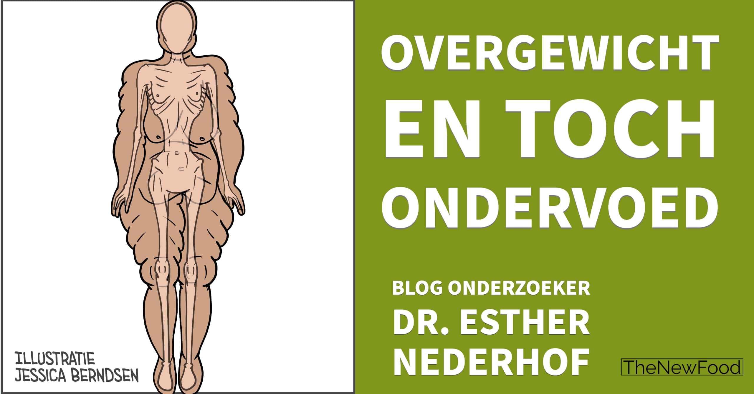 Overgewicht en toch ondervoed