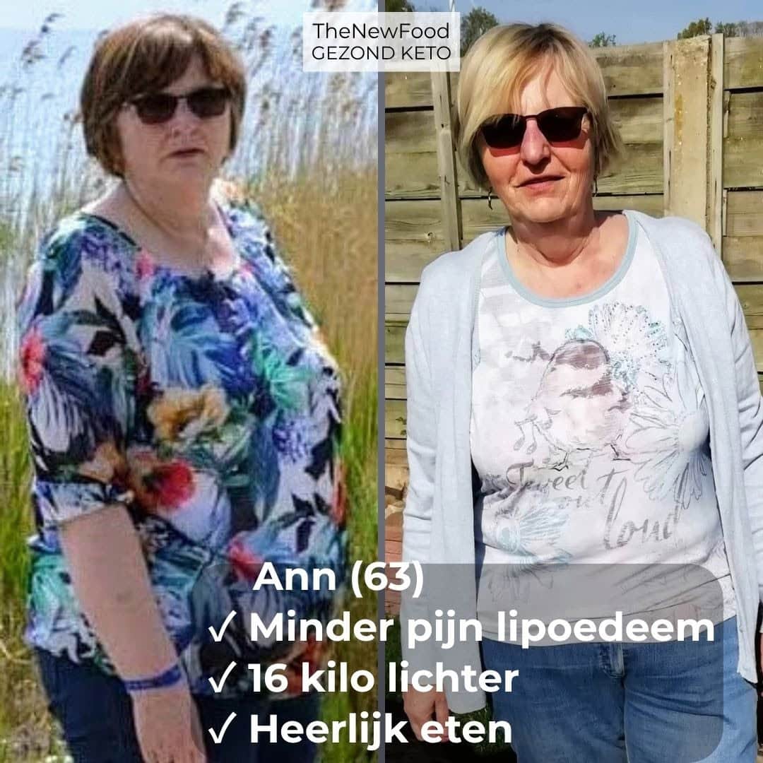 MINDER PIJN VAN LIPOEDEEM | 16 KILO KWIJT | HEERLIJK ETEN