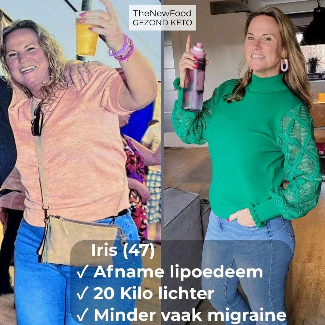 20 KILO LICHTER | PIJNKLACHTEN LIPOEDEEM VERDWENEN | WANDELEN LUKT WEER