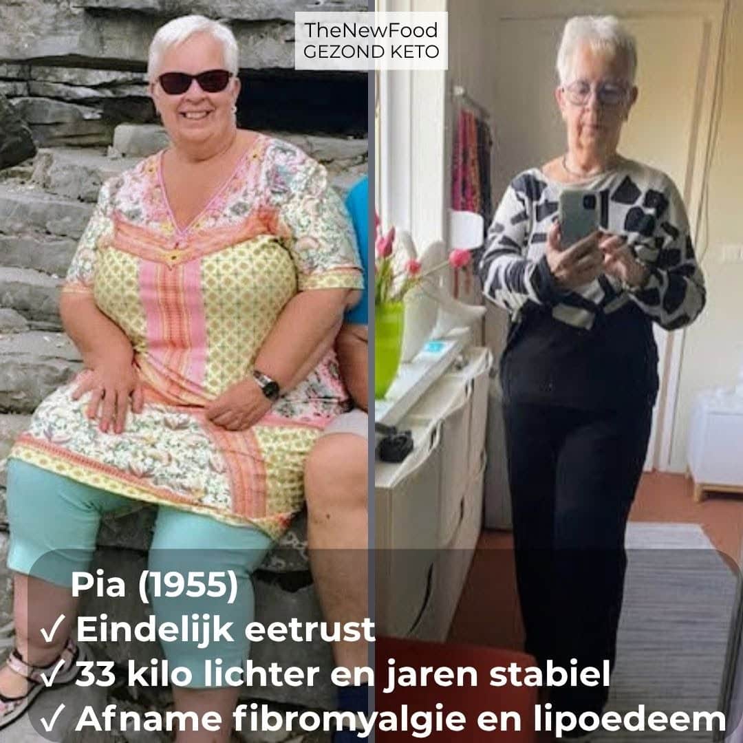 33 KILO KWIJT | EINDELIJK EETRUST | MINDER LAST LIPOEDEEM/LYMFOEDEEM EN FIBROMYALGIE | AL JAREN STABIEL OP GEWICHT