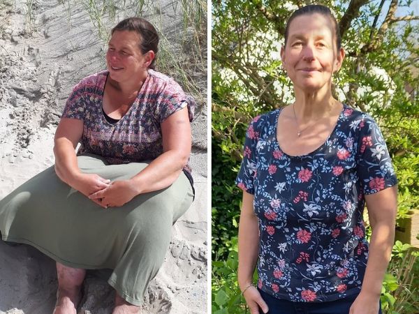 45 KILO KWIJT | LIPOEDEEMKLACHTEN ENORM AFGENOMEN