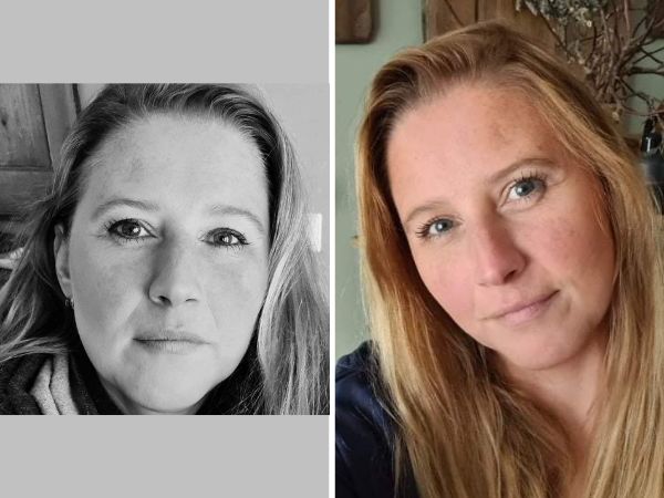 EINDELIJK VEEL MINDER PIJN DOOR LIPOEDEEM | DUNNERE BENEN