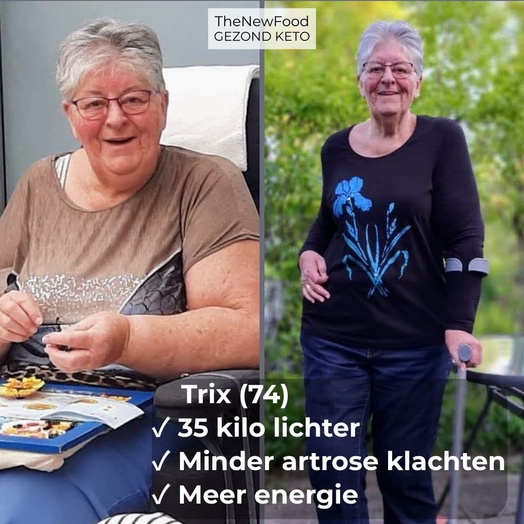 35 KILO KWIJT | MINDER LAST VAN ARTROSE | MEER ENERGIE