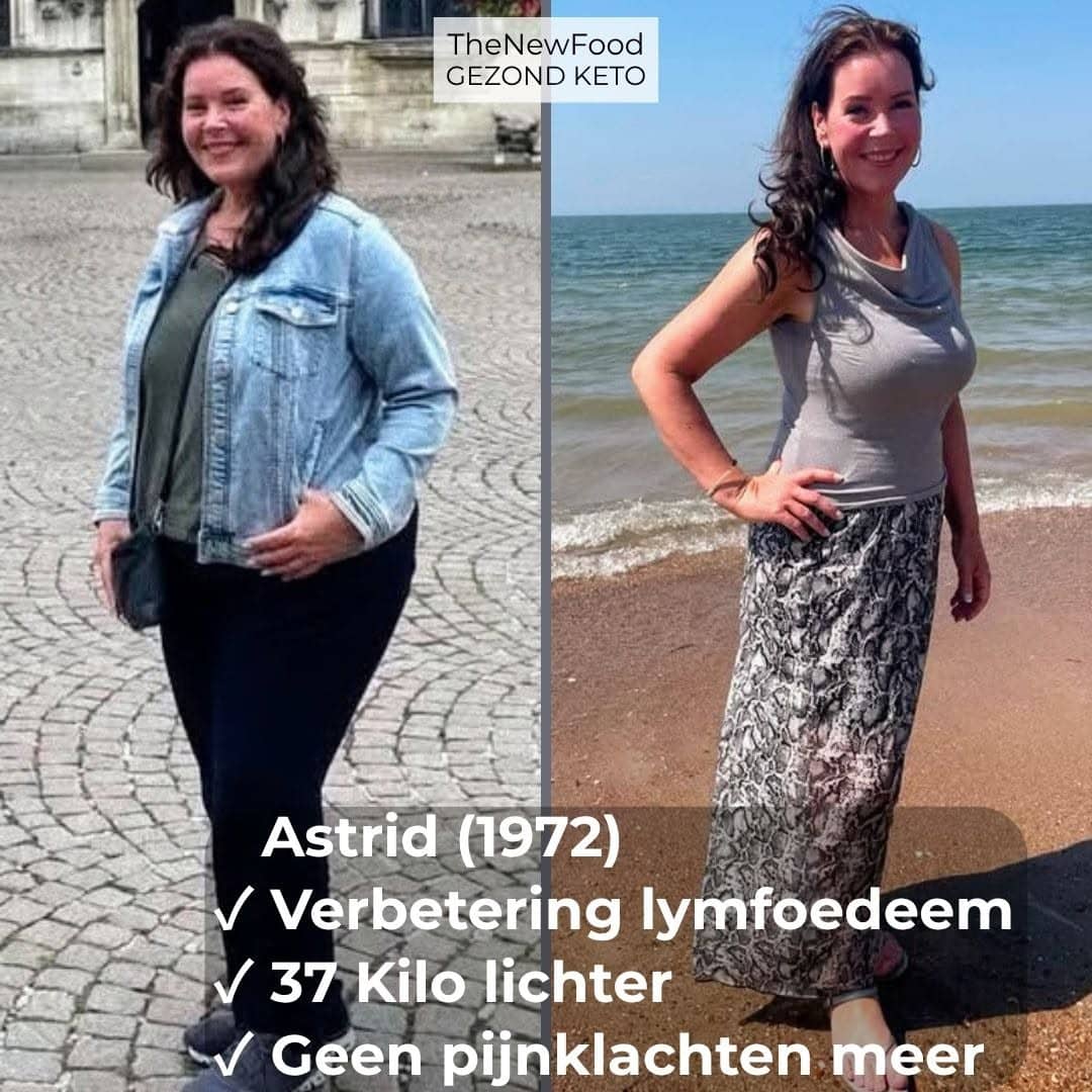 VERBETERING LYMFOEDEEM | 37 KILO LICHTER | EINDELIJK EETRUST | GEEN PIJNKLACHTEN MEER